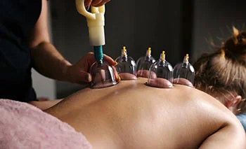 Cupping therapy Brisbane City – static and glide techniques